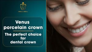 venus porcelain crown