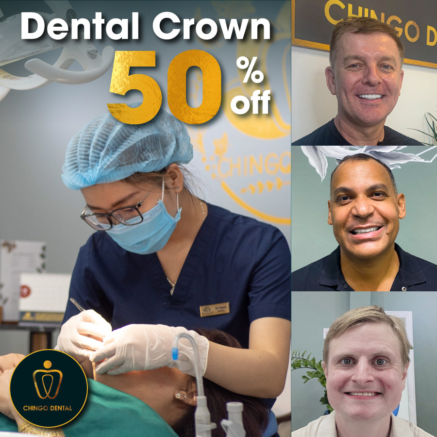 Sale up to 50% dental crowns dental veneers