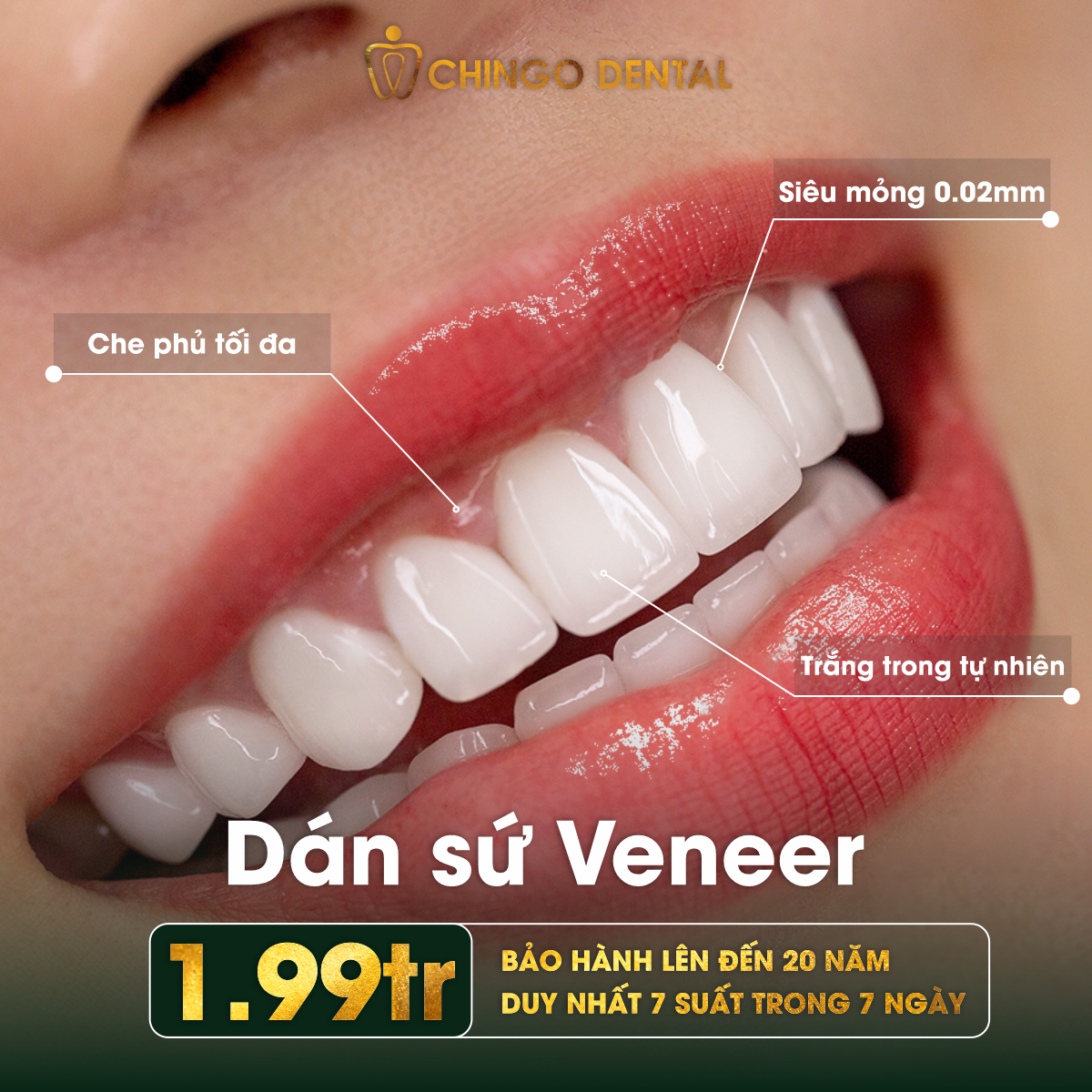 Dan su Veneer