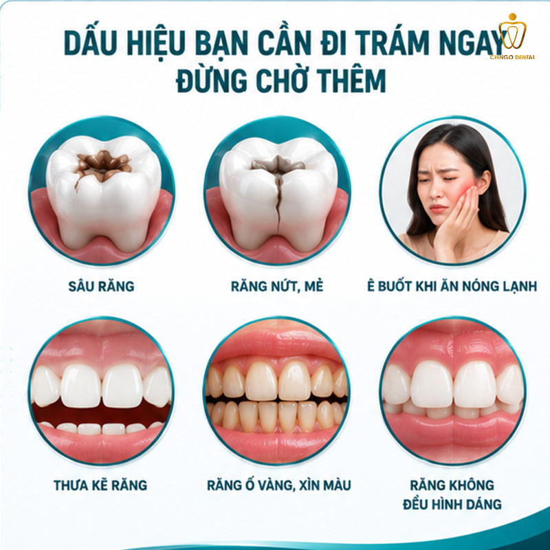 Trám Răng: Hướng Dẫn Toàn Diện Từ A-Z - Khi Nào Cần Trám, Chọn Loại Nào & Chi Phí Thực Tế 2 dấu hiệu cần đi trám răng