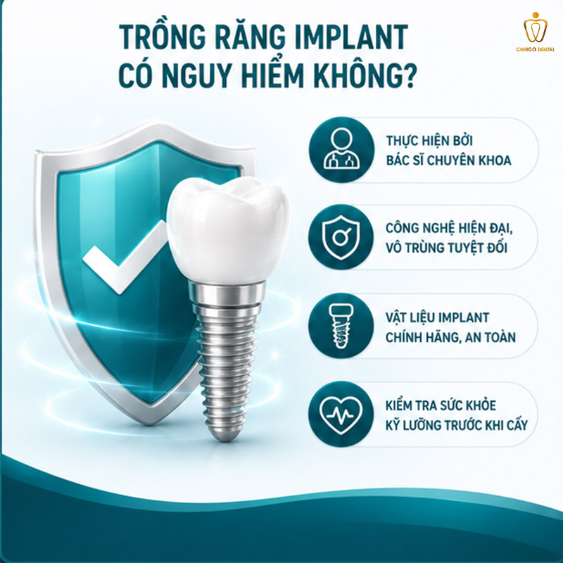 Trồng Răng Implant Mất Bao Lâu? Quy Trình, Thời Gian Phục Hồi & Những Điều Cần Biết Trước Khi Làm 3 làm răng implant