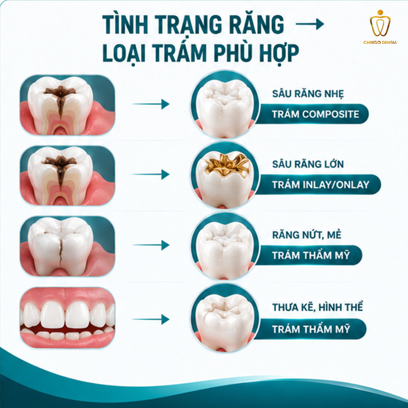 Trám Răng: Hướng Dẫn Toàn Diện Từ A-Z - Khi Nào Cần Trám, Chọn Loại Nào & Chi Phí Thực Tế 3 tình trạng răng cần trám