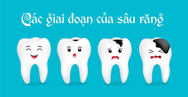 tram-rang-nhung-dieu-can-biet-chingo-dental