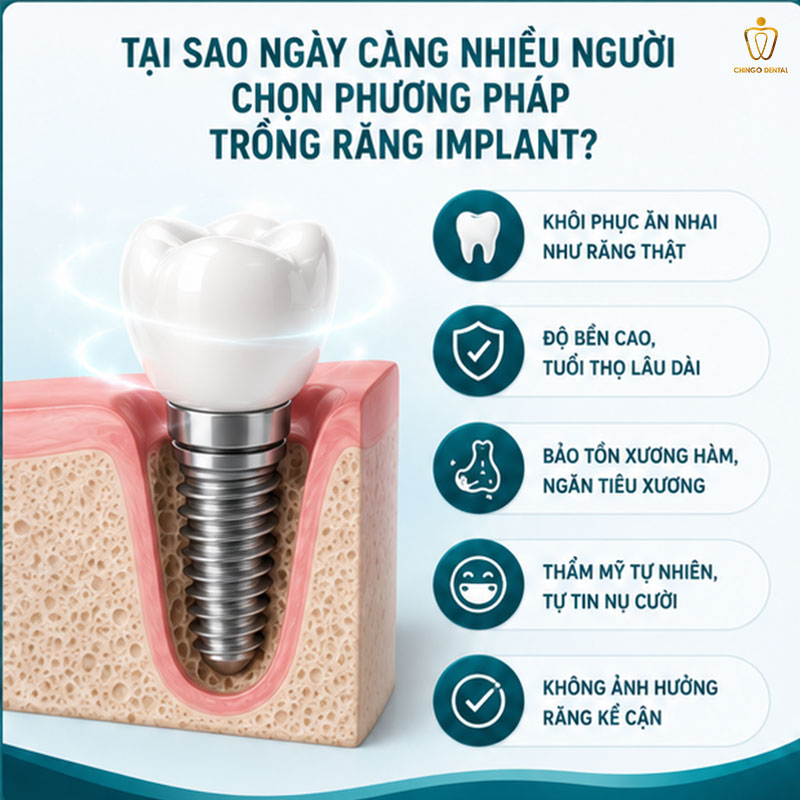 Trồng Răng Implant Mất Bao Lâu? Quy Trình, Thời Gian Phục Hồi & Những Điều Cần Biết Trước Khi Làm 1 trồng răng implant mất bao lâu