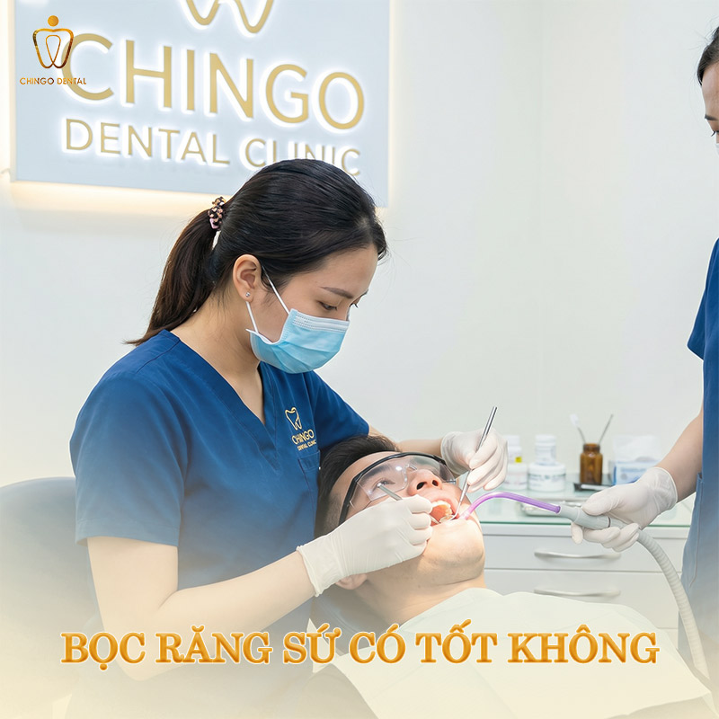 Có Nên Bọc Răng Sứ Thẩm Mỹ Không? Bác Sĩ Giải Đáp Từ A–Z Để Bạn Quyết Định Đúng 1 bọc răng sứ có tốt không