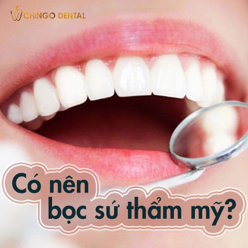 co-nen-boc-su-khong-chingo-dental-web-chingo-dental