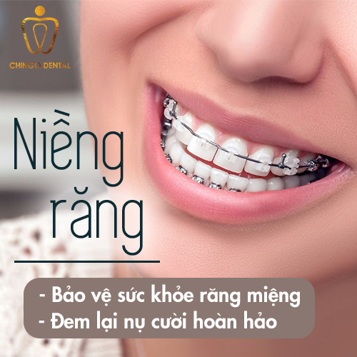nieng-rang-la-gi-web-chingo-dental