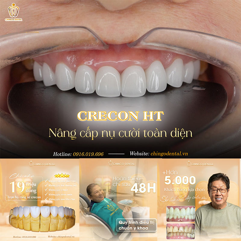 sứ zirconia và sứ thường khác gì nhau