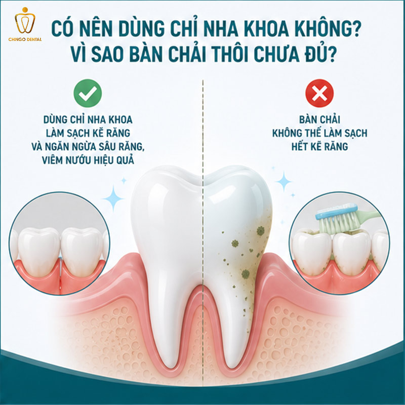 Chỉ Nha Khoa: Cách Dùng, Loại Tốt Nhất & Tất Cả Điều Bạn Cần Biết 3 tăm nha khoa