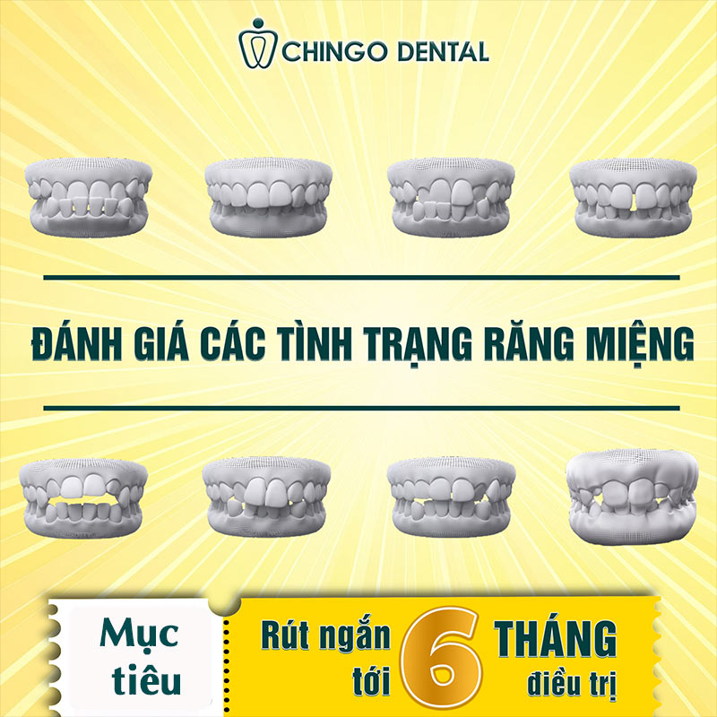 Các Phương Pháp Niềng Răng Hiện Nay — Loại Nào Phù Hợp, Có Đau Không Và Bao Nhiêu Tiền? 1 các kiểu niềng răng