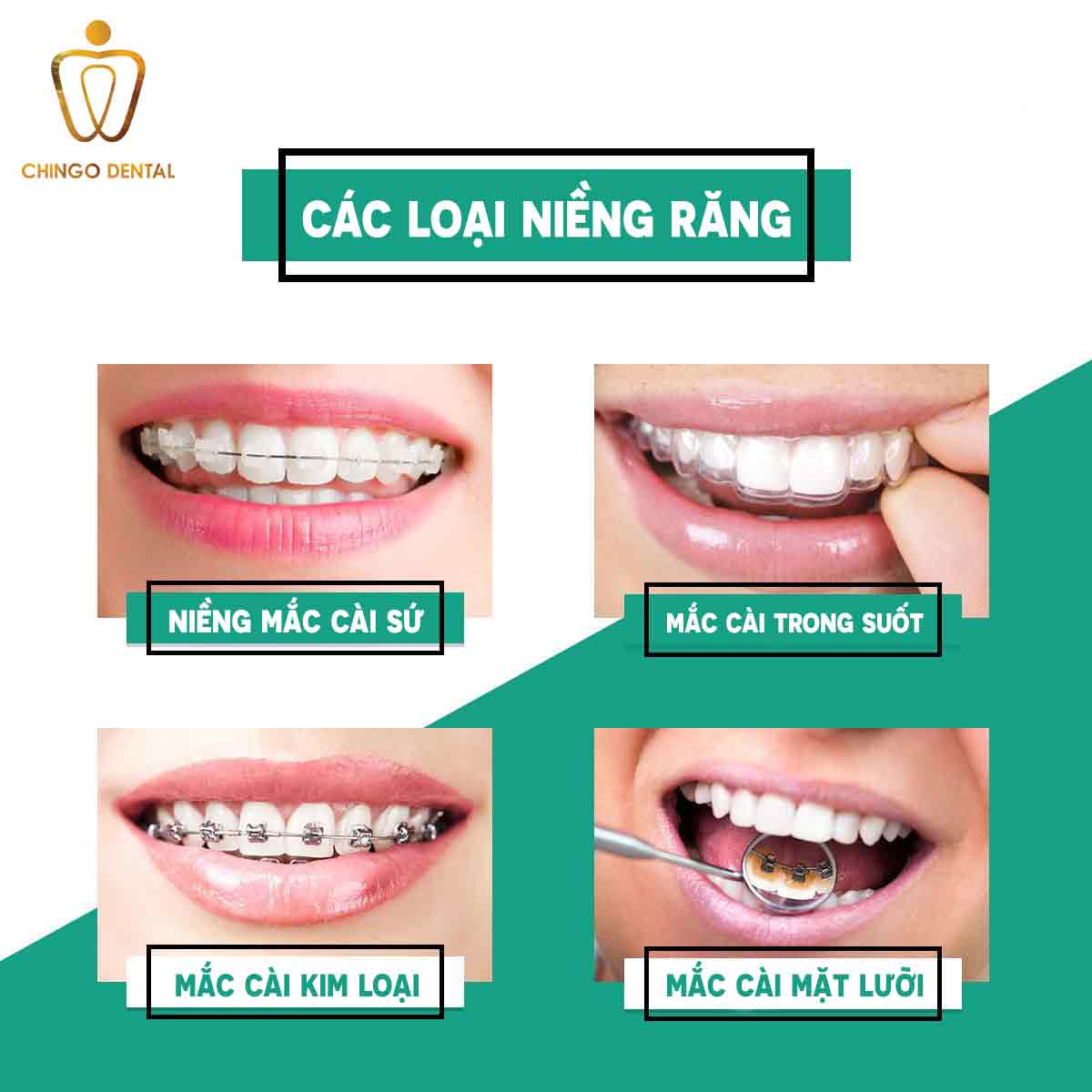 cac-loai-nieng-rang-final-chingo
