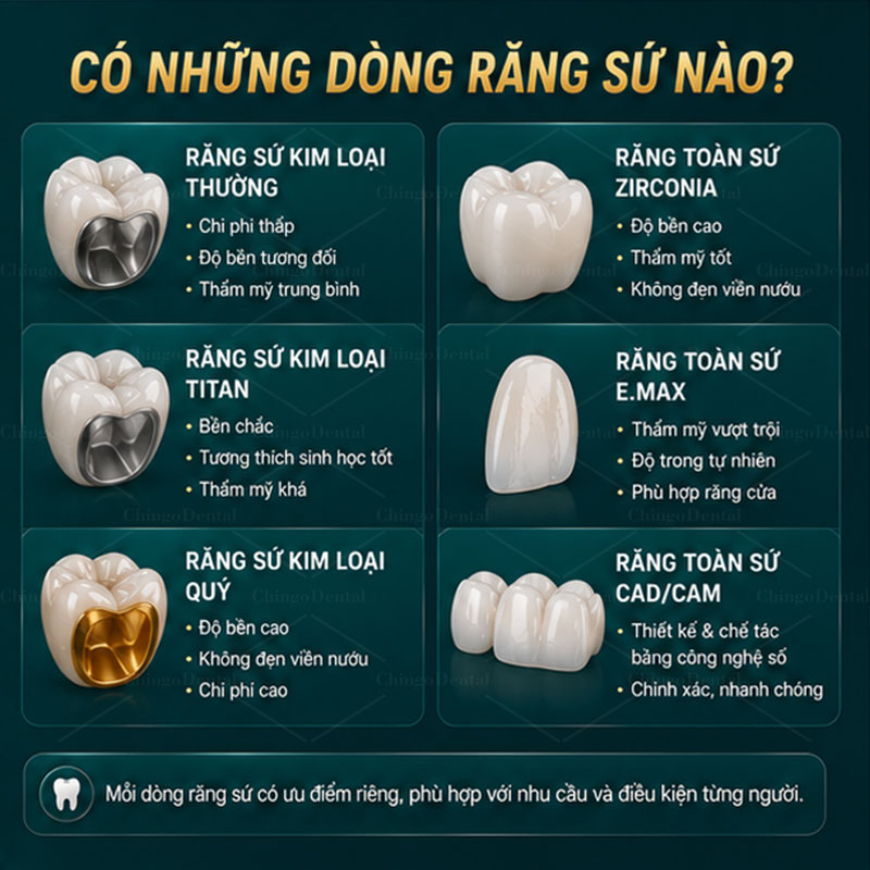 Răng Sứ Là Gì? Nhận Biết Các Loại Răng Sứ - Cẩm Nang Toàn Tập 2 có những loại răng sứ nào
