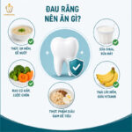 Đau Răng Kiêng Ăn Gì? Chuyên Gia Nha Khoa Chỉ Ra Những Thực Phẩm Nên Tránh Và Nên Ăn đau răng nên ăn gì