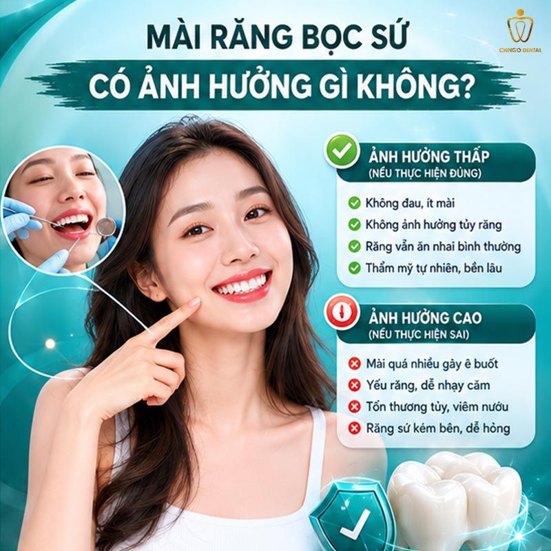 mài răng để bọc sứ