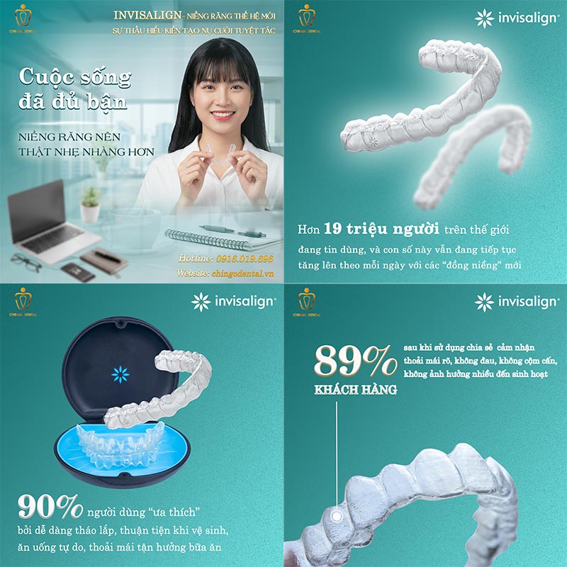 Các Phương Pháp Niềng Răng Hiện Nay — Loại Nào Phù Hợp, Có Đau Không Và Bao Nhiêu Tiền? 5 niềng răng trong suốt