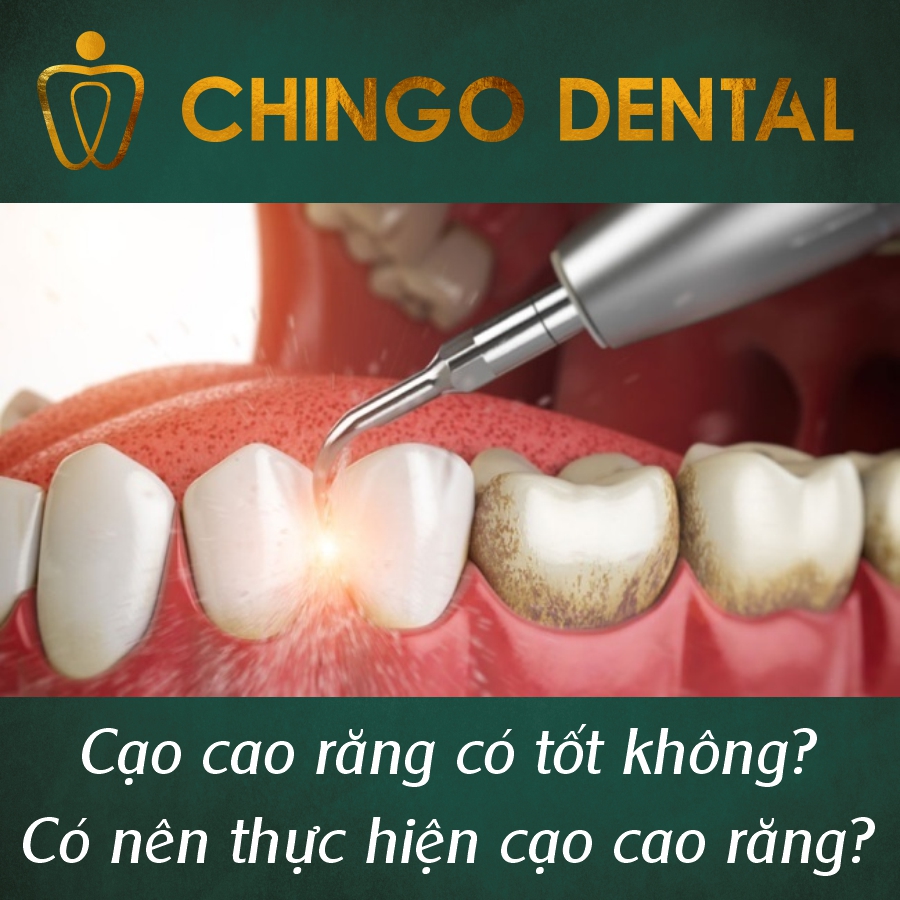 Cao Cao Rang Chingo Dental
