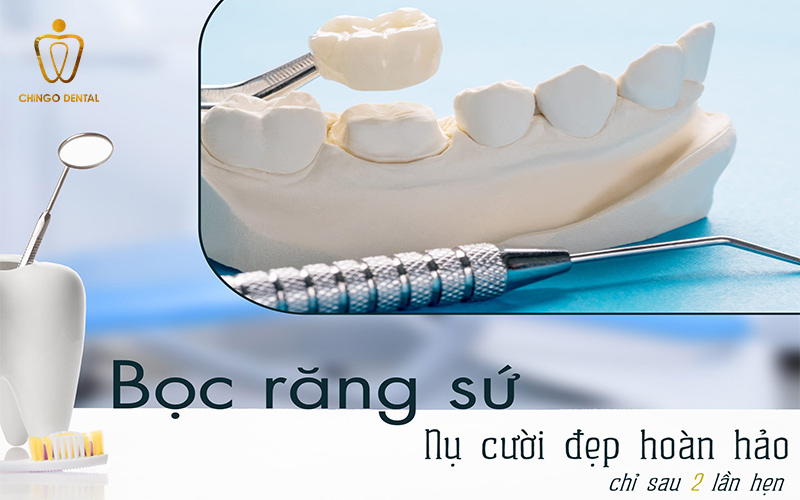 bọc răng sứ mất bao lâu