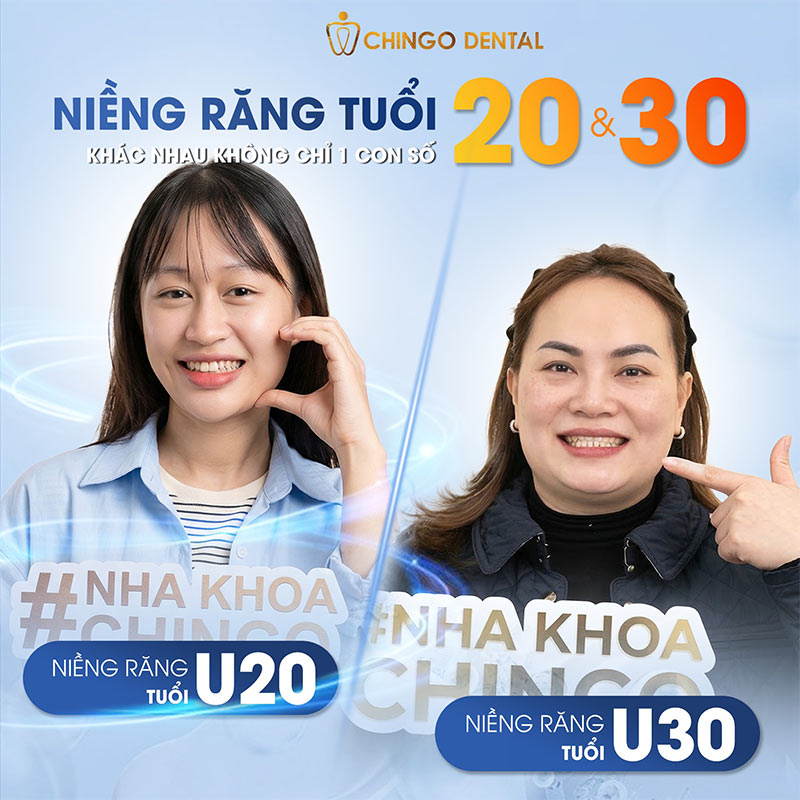 Thời Điểm Nào Thích Hợp Để Niềng Răng? Giải Đáp Toàn Diện Theo Từng Độ Tuổi 6 có nên niềng răng hay không