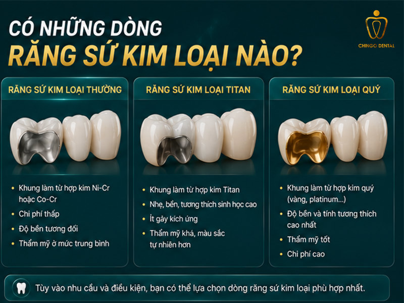 Răng Sứ Kim Loại Là Gì? 3 Loại Phổ Biến & Cách Chăm Sóc Bền Lâu 2 Có những dòng răng sứ kim loại nào