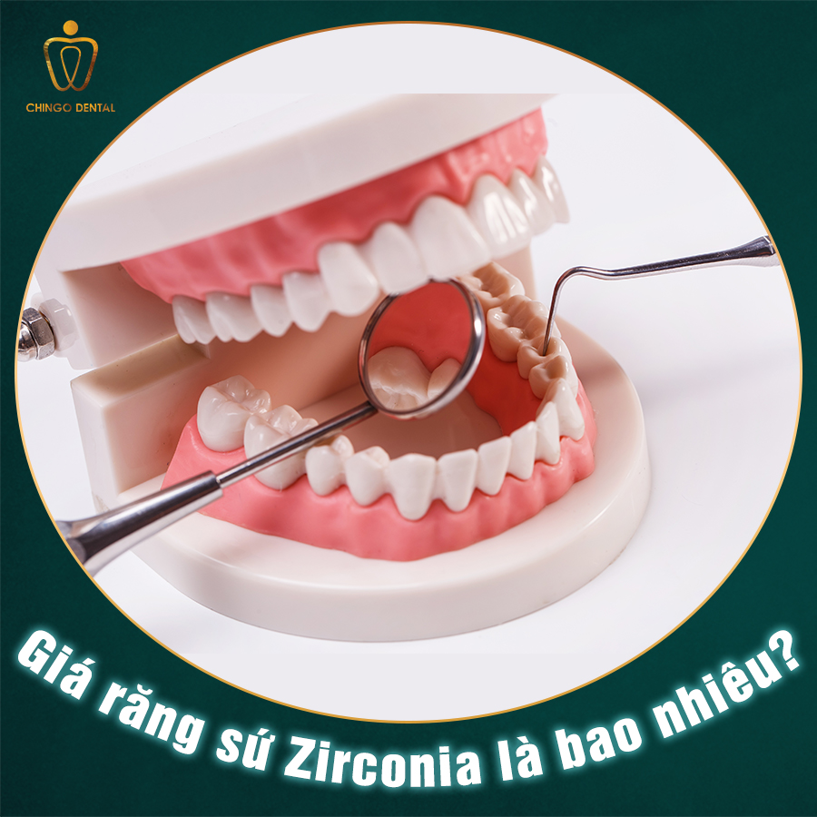 Gia Rang Su Zirconia Chingo Dental