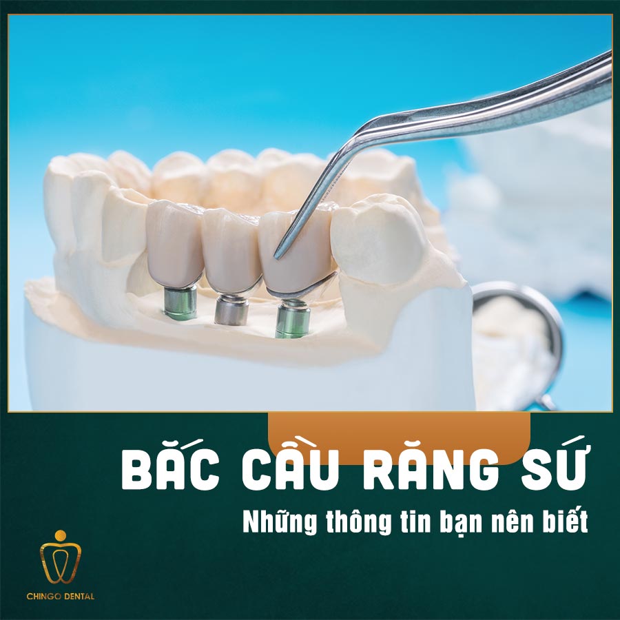 Lam Cau Rang Su Chingo Dental