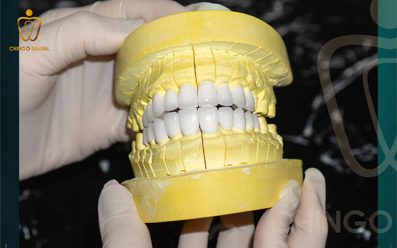 làm răng sứ ở đâu tốt