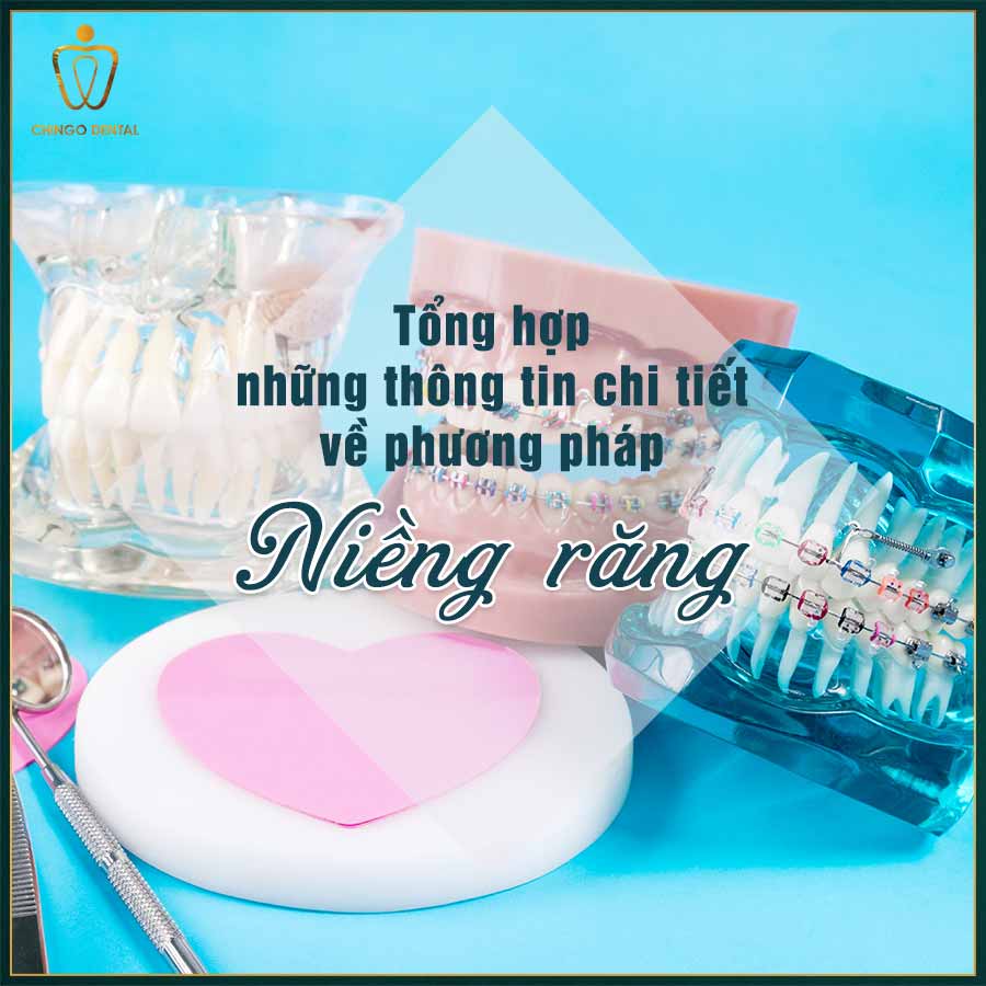 Nieng Rang Chingo Dental