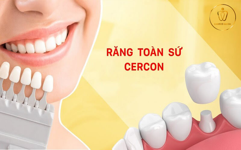 Rang Su Cercon Co Tot Khong Chingo Dental 3