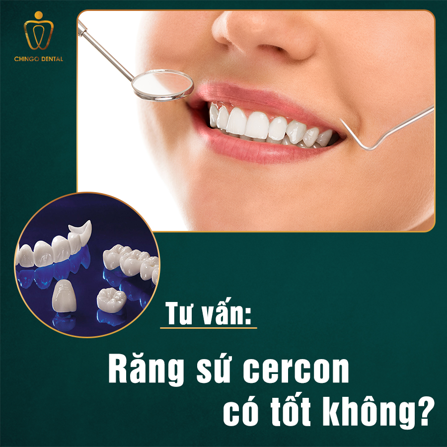 Rang Su Cercon Co Tot Khong Chingo Dental
