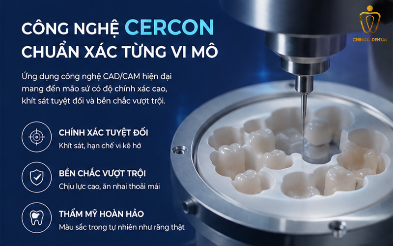 Giải Mã Sức Hút Của Răng Sứ Cercon: Lựa Chọn Vàng Cho Nụ Cười Rạng Rỡ 4 răng sứ cercon ht