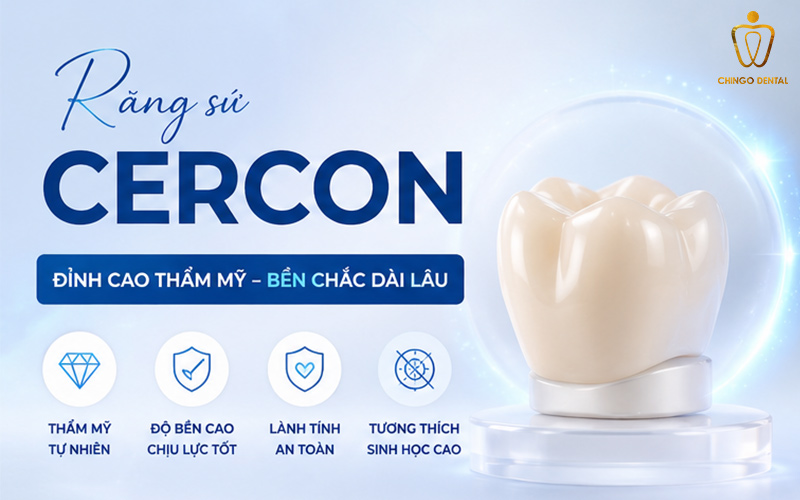 Giải Mã Sức Hút Của Răng Sứ Cercon: Lựa Chọn Vàng Cho Nụ Cười Rạng Rỡ 1 răng sứ cercon