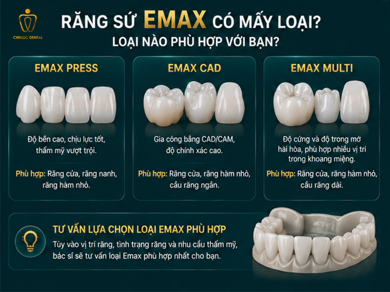Răng Sứ Emax Là Gì? Giá Bao Nhiêu, Có Mấy Loại & Có Tốt Không — Giải Đáp Toàn Diện 5 răng sứ emax giá bao nhiêu