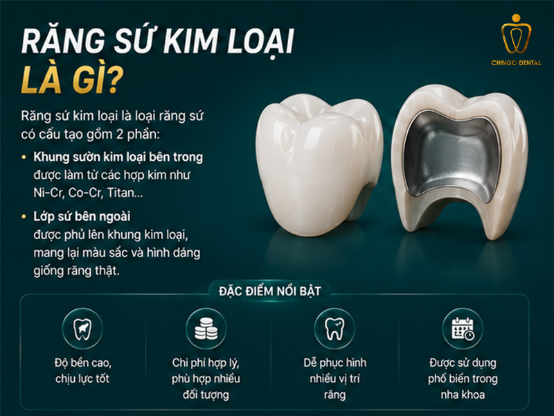Răng Sứ Kim Loại Là Gì? 3 Loại Phổ Biến & Cách Chăm Sóc Bền Lâu 19 răng sứ kim loại là gì
