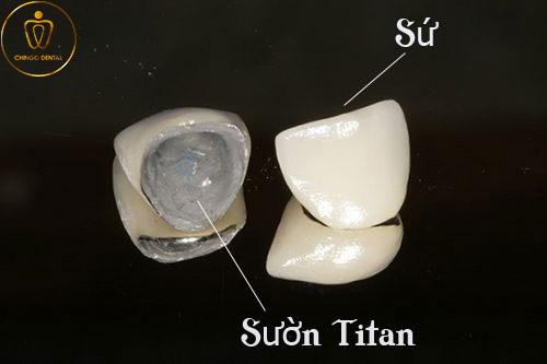 Rang Su Titan Chingo Dental 1