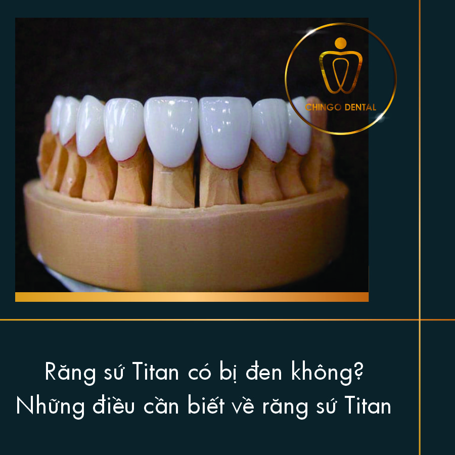 Rang Su Titan Co Bi Den Khong Chingo Dental