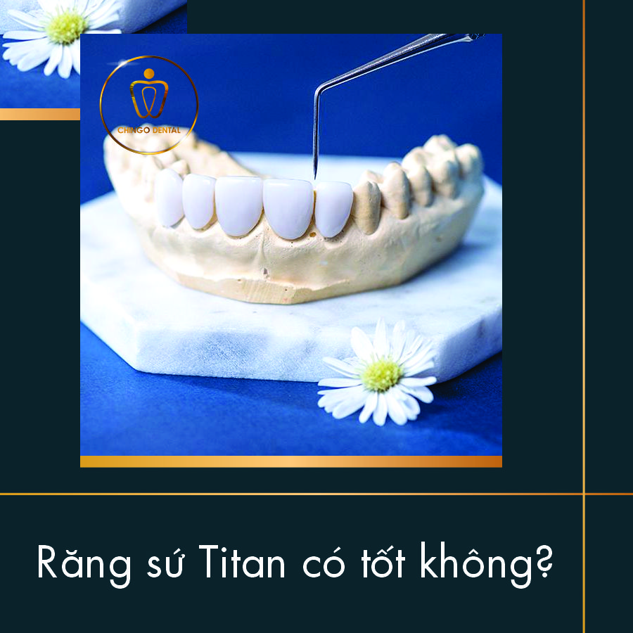 Rang Su Titan Co Tot Khong