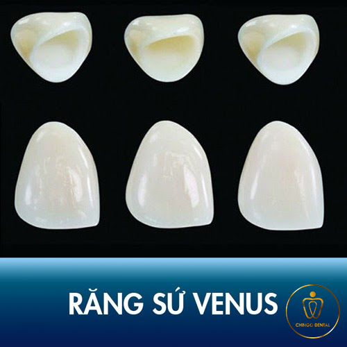 Rang Su Venus Chingo Dental 2