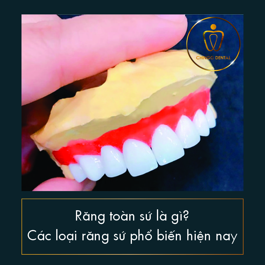 Rang Toan Su Chingo Dental
