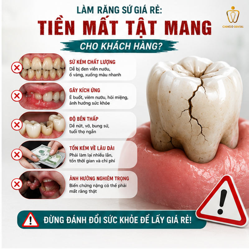 Làm Răng Sứ Giá Rẻ: Vì Sao Không Nên Thực Hiện? 3 tác hại làm răng sứ giá rẻ