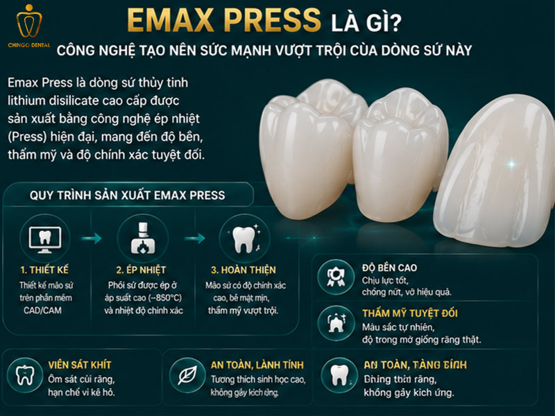 Răng Sứ Emax Là Gì? Giá Bao Nhiêu, Có Mấy Loại & Có Tốt Không — Giải Đáp Toàn Diện 3 veneer emax