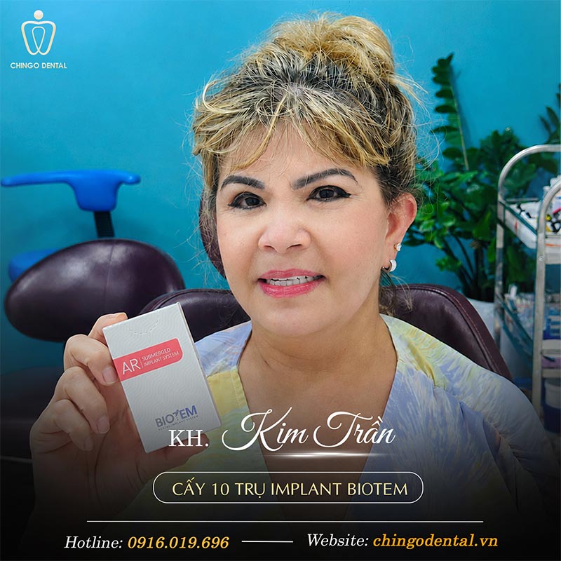 Răng Implant Hàn Quốc: Phân Loại, So Sánh Các Hãng & Bảng Giá Mới Nhất 6 implant hàn quốc