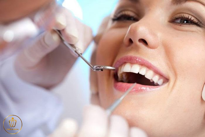 Implant Nha Khoa La Gi Chingo Dental 3