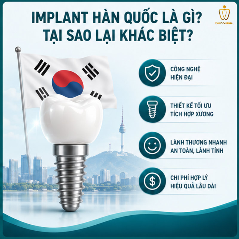Răng Implant Hàn Quốc: Phân Loại, So Sánh Các Hãng & Bảng Giá Mới Nhất 1 răng implant hàn quốc