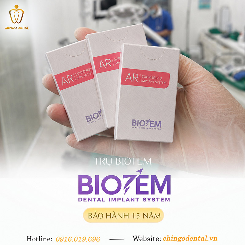 Răng Implant Hàn Quốc: Phân Loại, So Sánh Các Hãng & Bảng Giá Mới Nhất 4 implant biotem