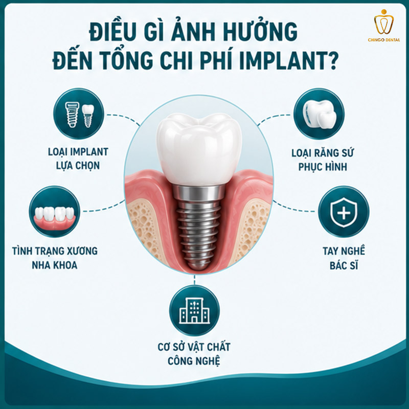 Răng Implant Hàn Quốc: Phân Loại, So Sánh Các Hãng & Bảng Giá Mới Nhất 5 trụ implant hàn quốc