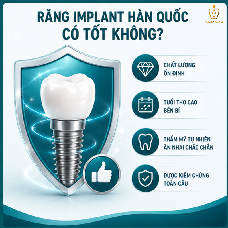 Răng Implant Hàn Quốc: Phân Loại, So Sánh Các Hãng & Bảng Giá Mới Nhất 2 trụ implant