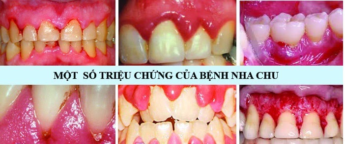 Benh Nha Chu Chingo Dental 3