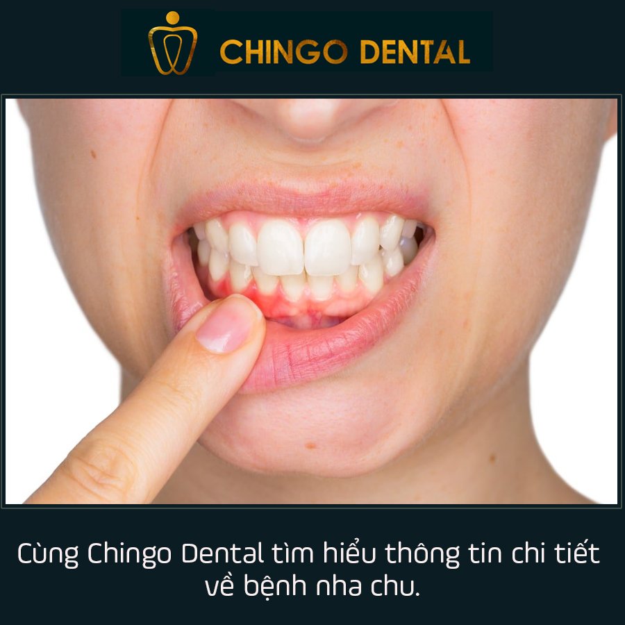Benh Nha Chu Chingo Dental