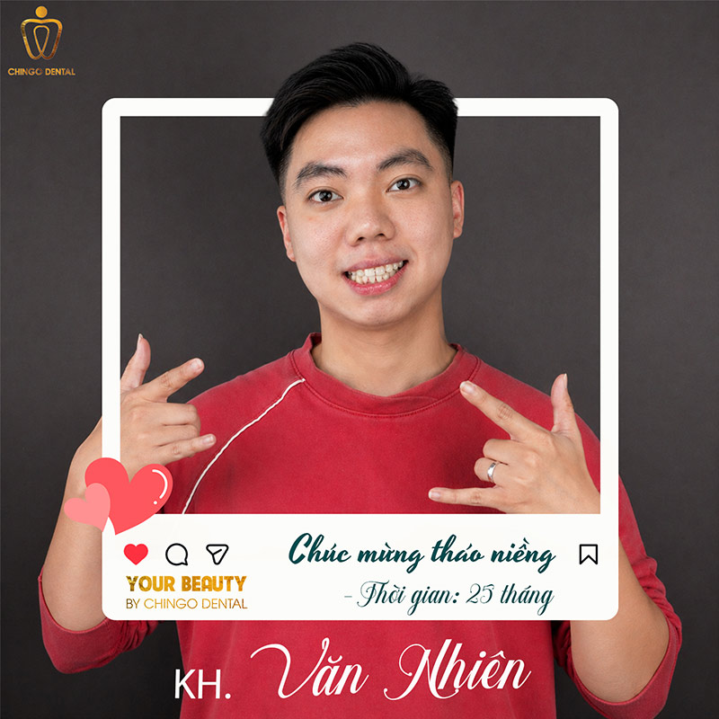 Quá Trình Niềng Răng Diễn Ra Như Thế Nào? Các Bước, Giai Đoạn & Thời Gian 3 các giai đoạn niềng răng