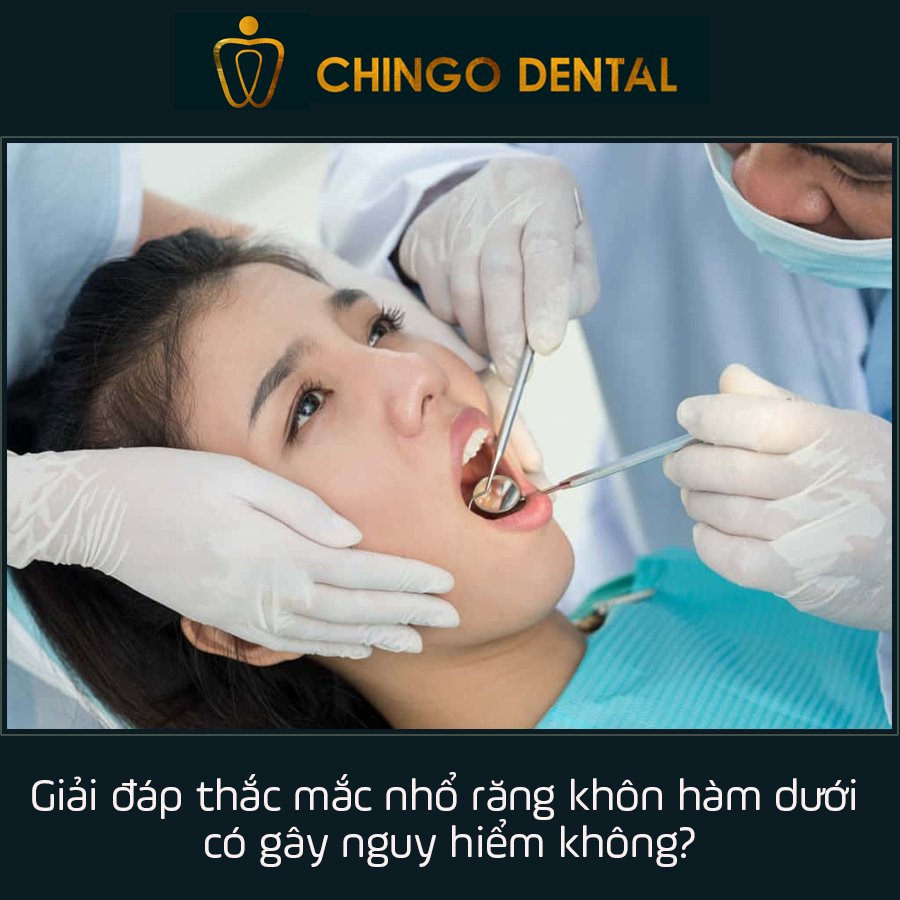 Nho Rang Khon Ham Duoi Chingo Dental